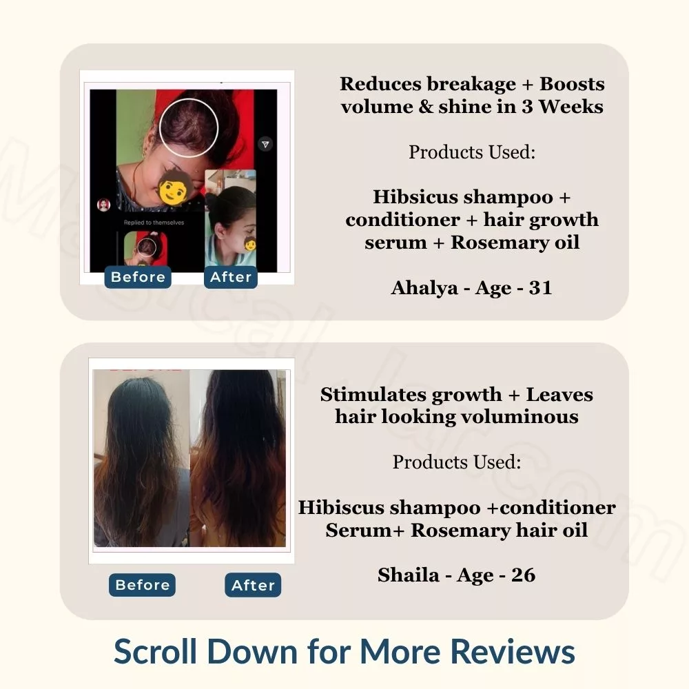 Hair Growth Serum | Infused with Biotin, Rosemary & Hibiscus