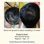 Hair Growth Serum | Infused with Biotin, Rosemary & Hibiscus