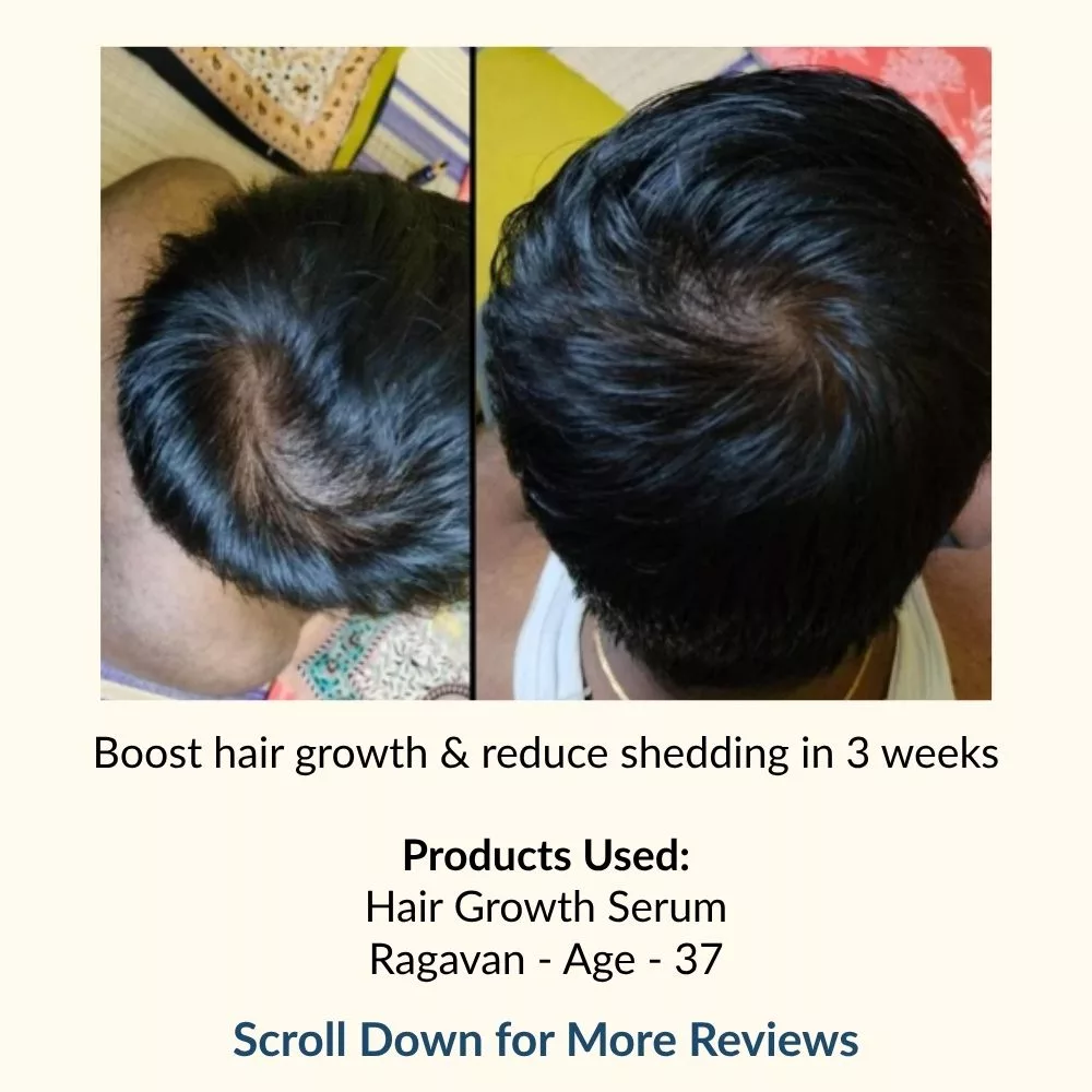 Hair Growth Serum | Infused with Biotin, Rosemary & Hibiscus
