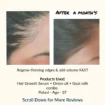 Hair Growth Serum | Infused with Biotin, Rosemary & Hibiscus