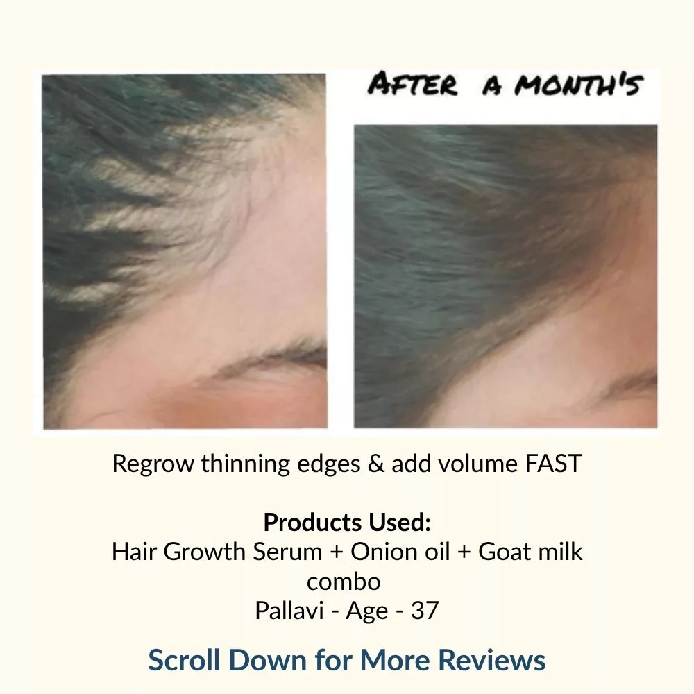 Hair Growth Serum | Infused with Biotin, Rosemary & Hibiscus