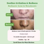 Aloe Vera Gel for Skin and Hair | Thick & Refreshing