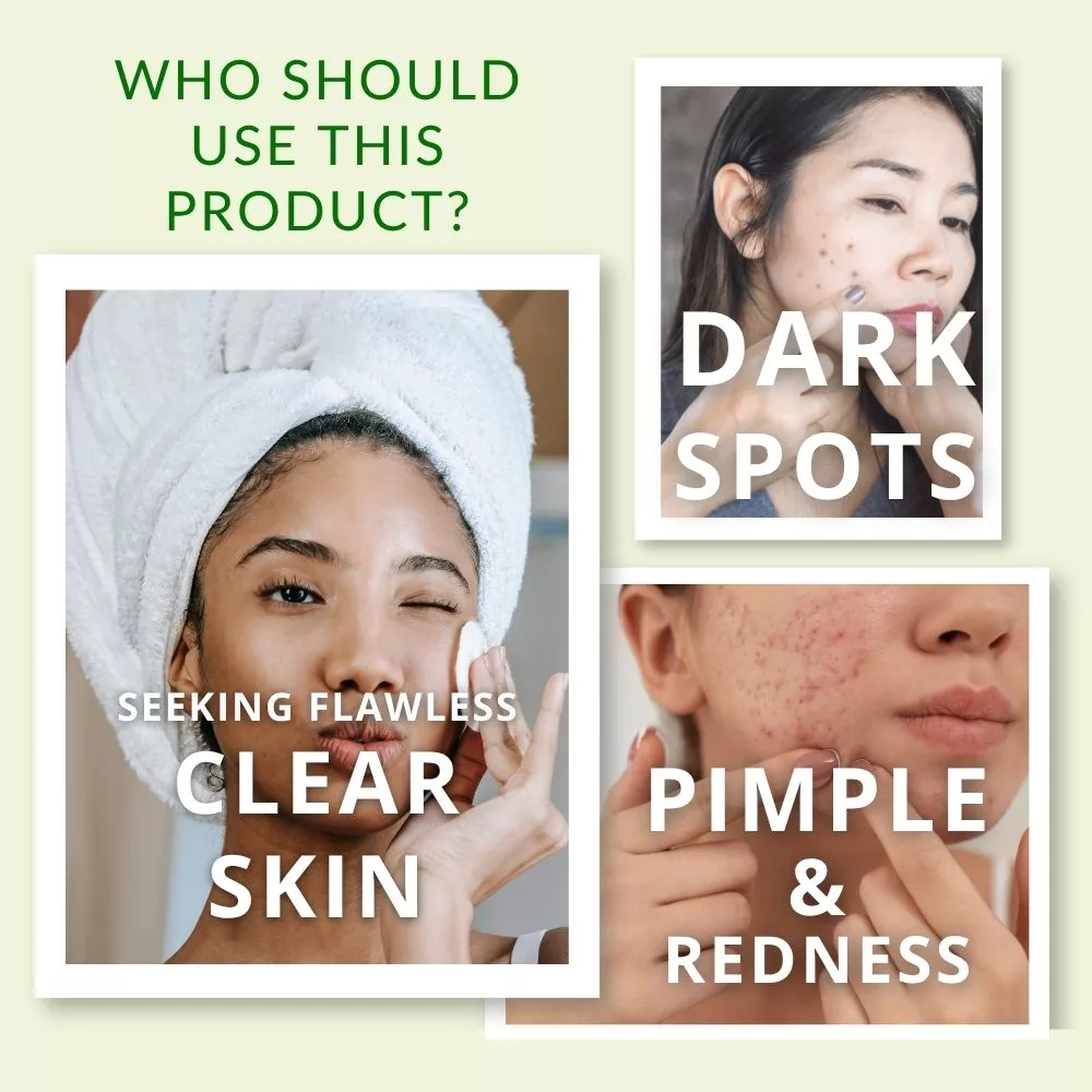 Pimple Care Face Serum