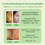 Pimple Care Face Serum