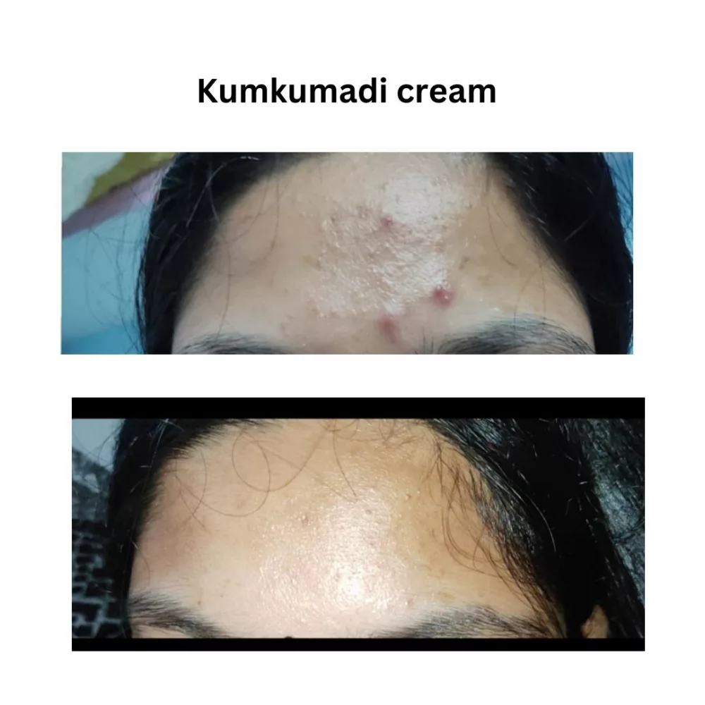 Kumkumadi Mini Kit Magical jar Reviews25