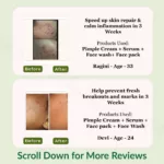 Pimple Care Mini Kit | Pack of 4