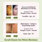 Pimple Care Mini Kit | Pack of 4