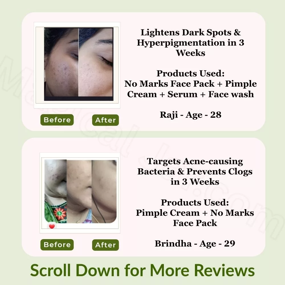 Pimple Care Mini Kit | Pack of 4