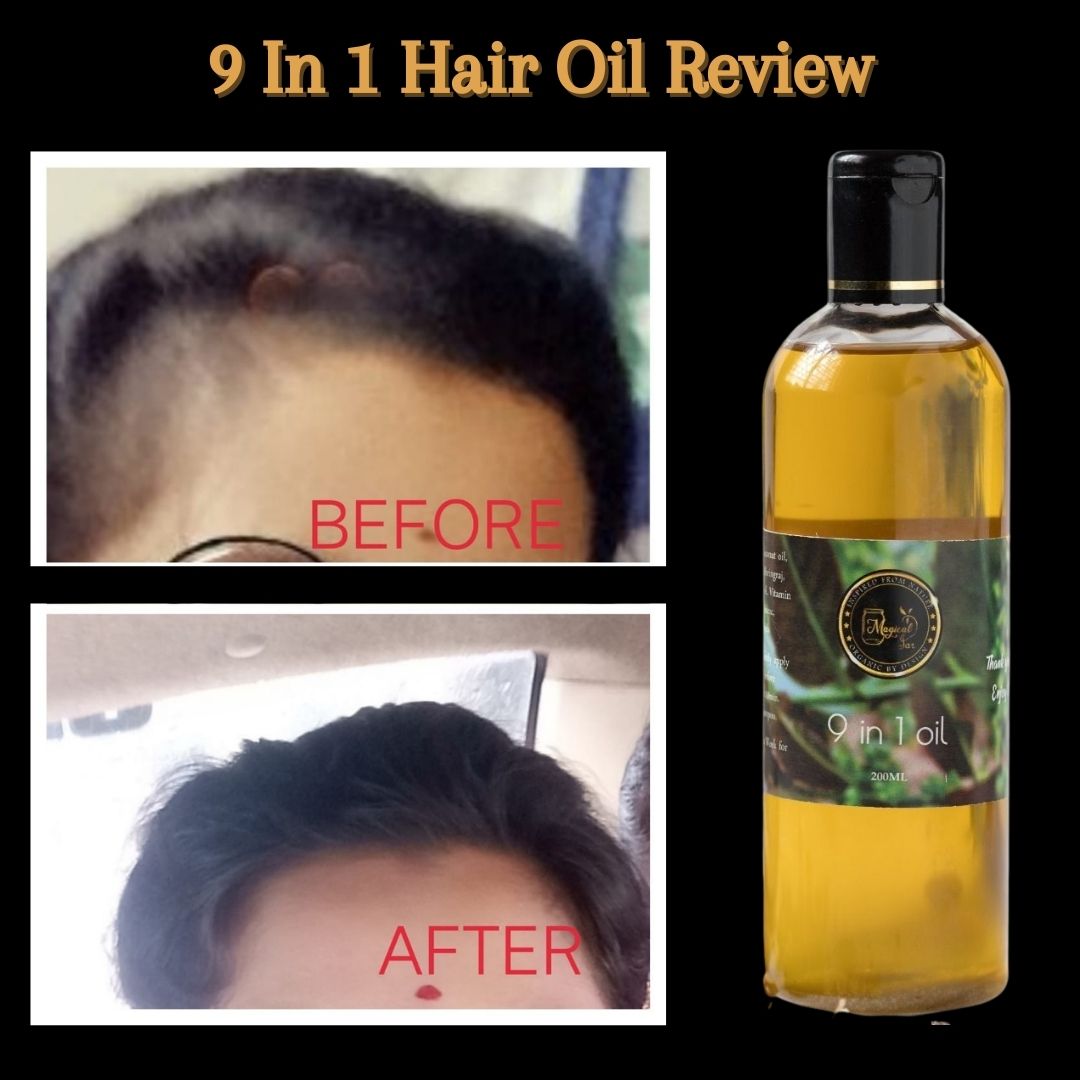 Onion  Biotin Hair Fall Control Duo  Shampoo  oil  For All hair Ty