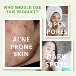 Pimple & Acne Control Face Mask