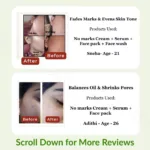 Pimple & Acne Control Face Mask