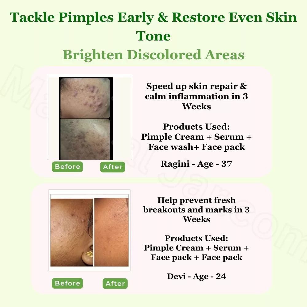 Tea Tree Face Wash - Purifying Pimple care face wash