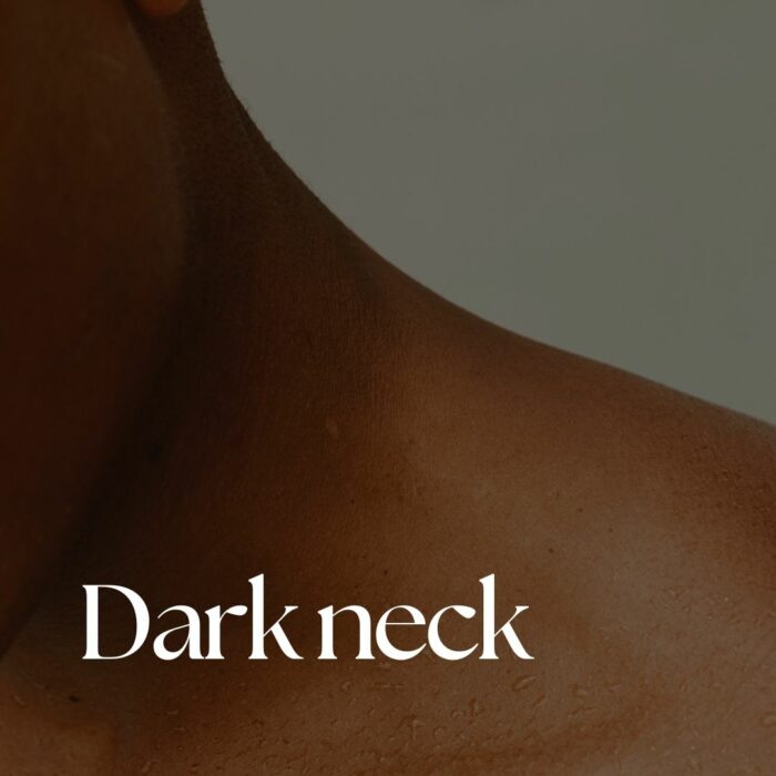 Dark Neck