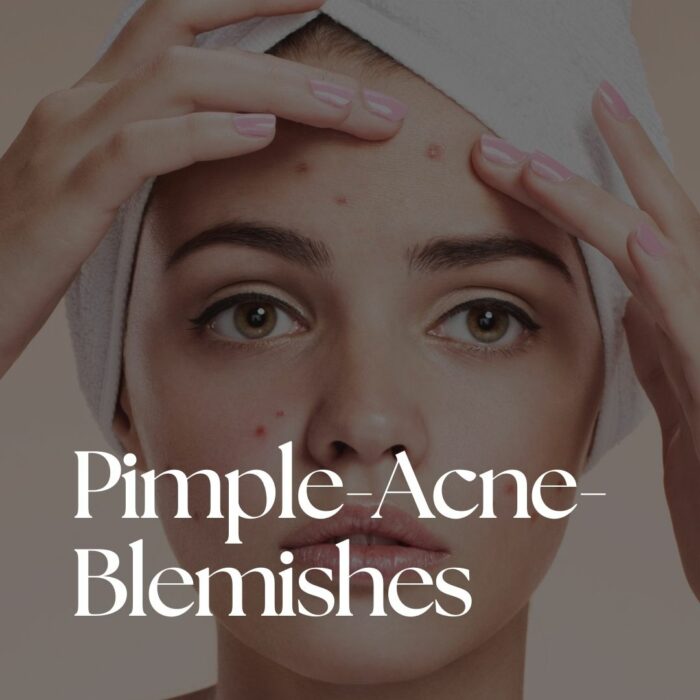 Acne-Pimples-Blemishes