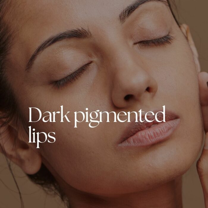 Dark Lips \ Pigmented lips