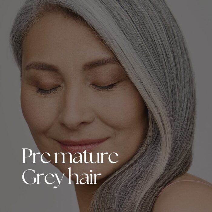 Premature Grey Hair