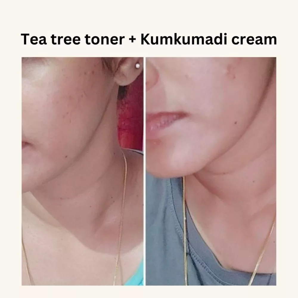 kumkumadi cream review10