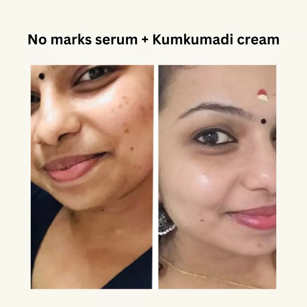 kumkumadi cream review11