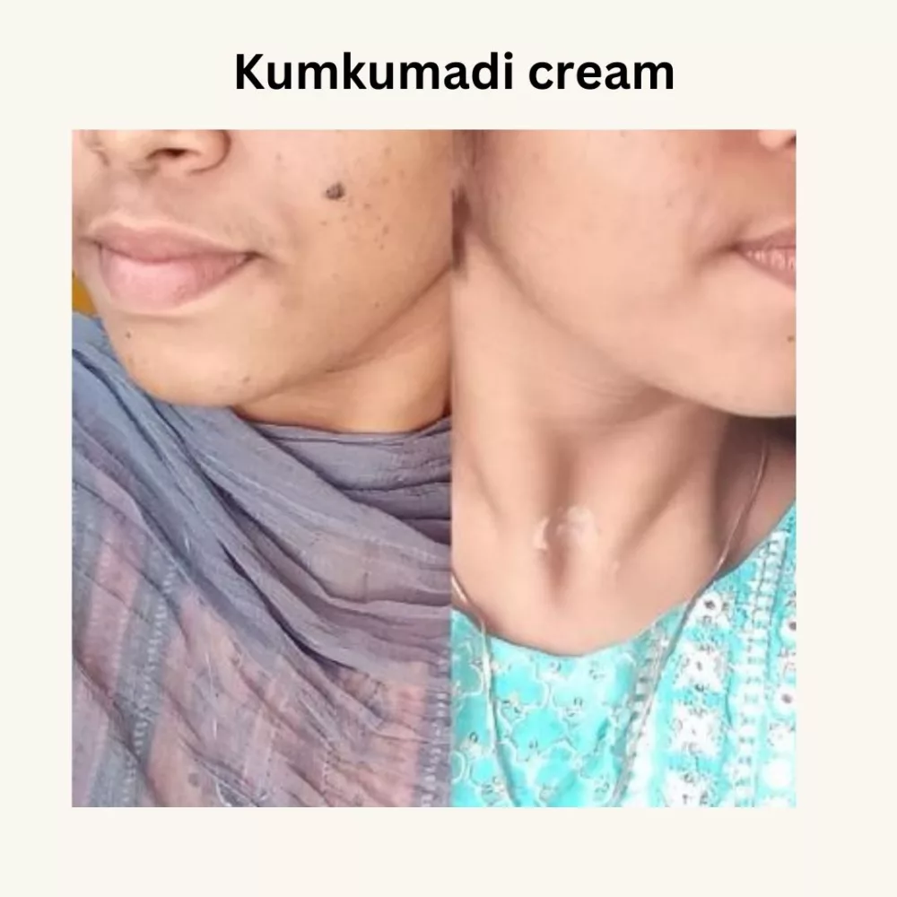 kumkumadi cream review9