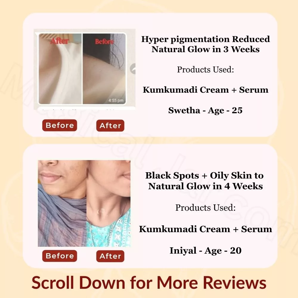 Kumkumadi Glow Duo I Serum & Cream