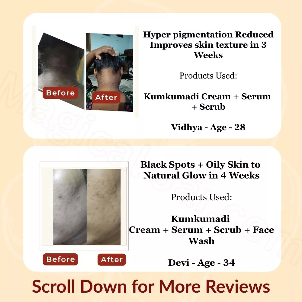 Kumkumadi Glow Duo I Serum & Cream