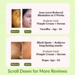 Pimple Care Duo I Pack of 2