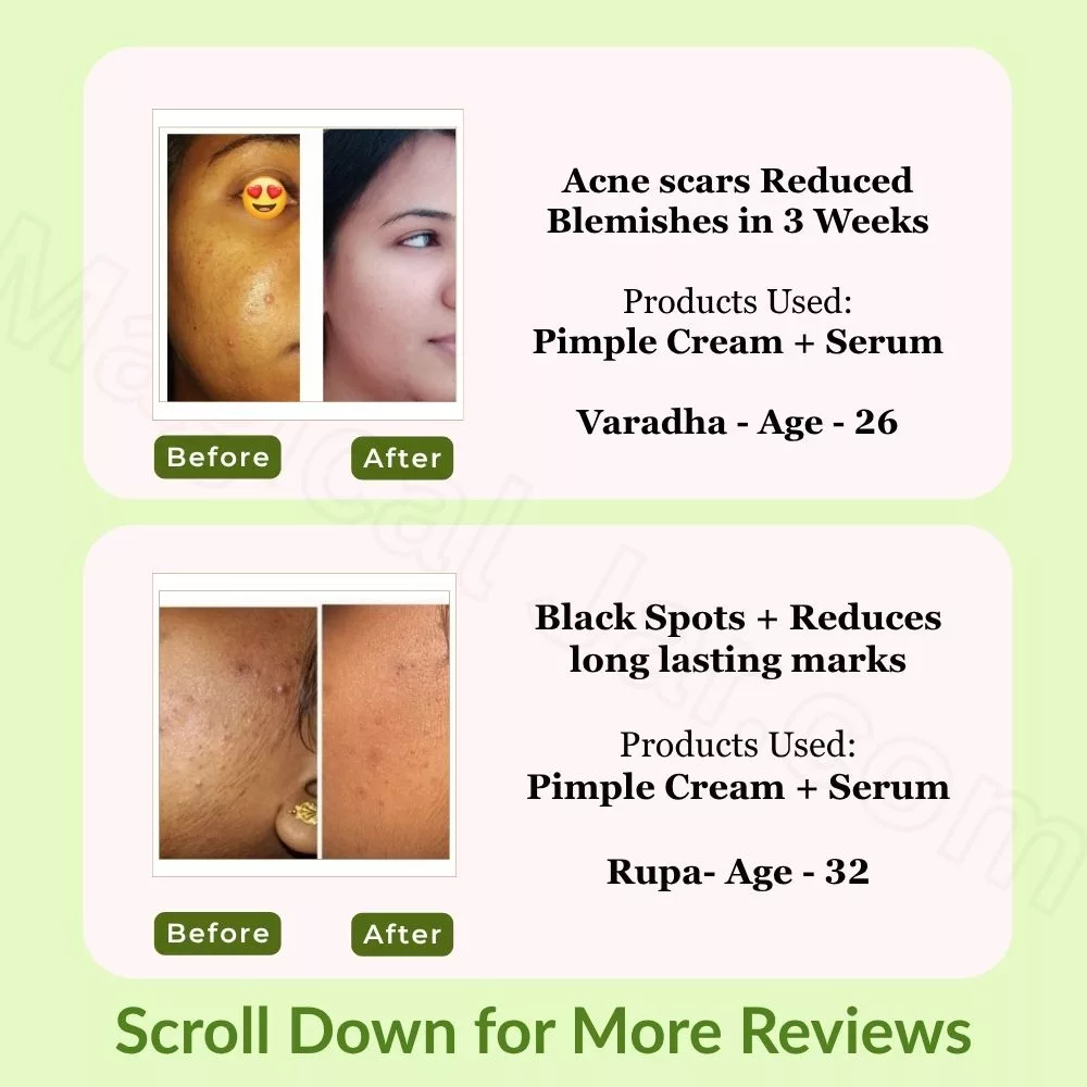 Pimple Care Duo I Pack of 2