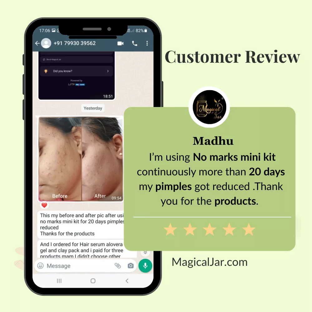 magicaljar pimple care range reviews13