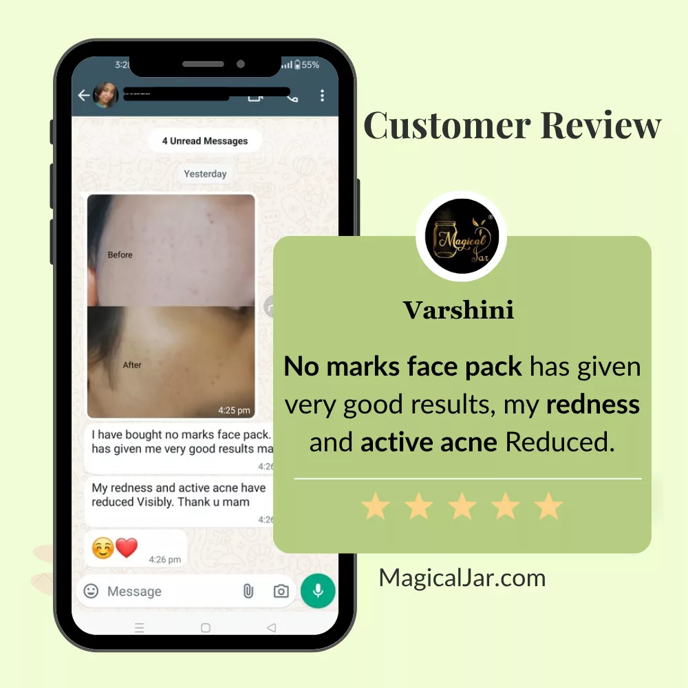 magicaljar pimple care range reviews4