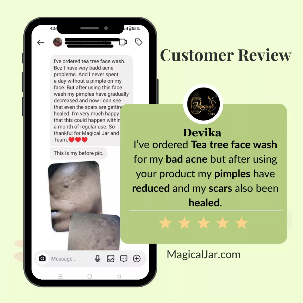 magicaljar pimple care range reviews6